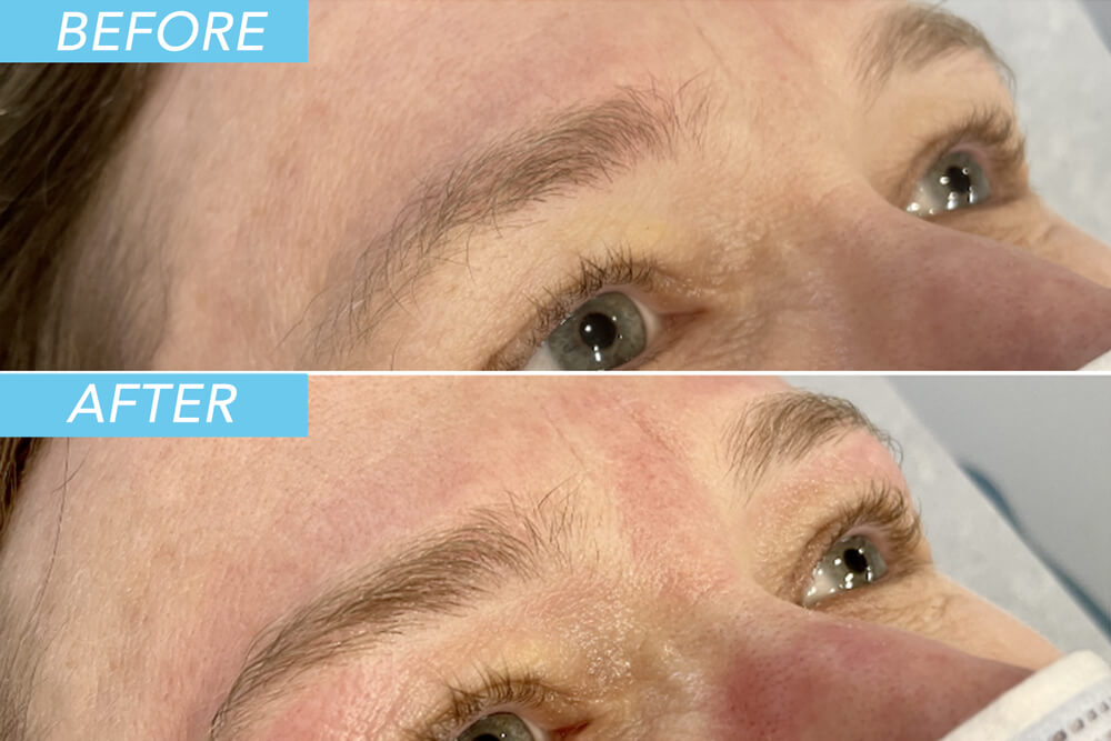 Before and after brow service at Brazilia Skin Care