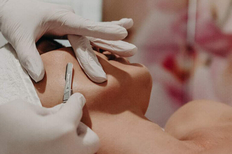 Woman getting a dermaplane procedure