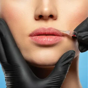 nurse filling lips of patient